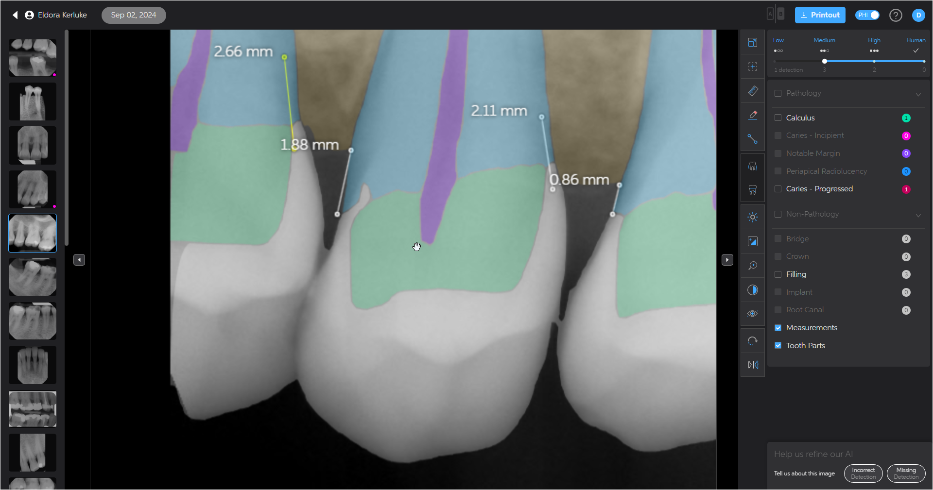 A screenshot of Second Opinion Ai in EXACT